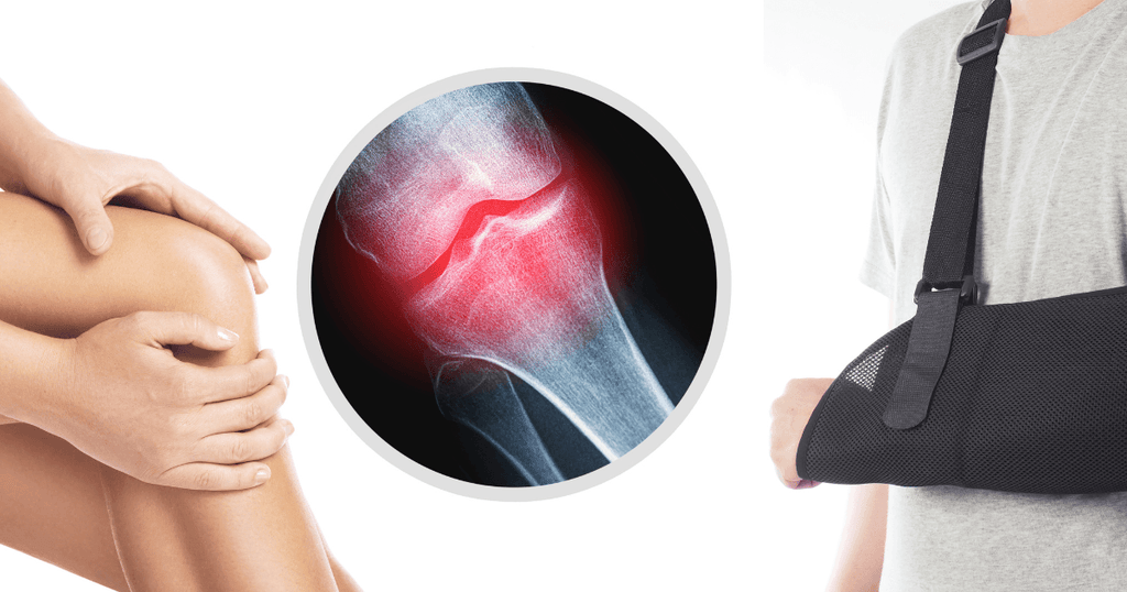 Common Boxing Injuries and Protective Measures – Mani Sports®